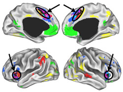 These brain images point out the areas most consistently active during a variety of cognitive tasks.
