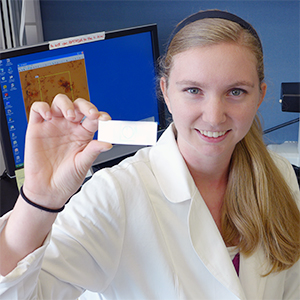 Second-year medical student Laura Bliss holds a slide containing cells from a patient treated for a bladder problem. As a participant in the Global Health Center's inaugural summer research program, Bliss studied bladder conditions commonly seen in women.