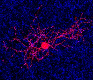 Using a labeling agent, researchers at Washington University School of Medicine in St. Louis have been able to isolate and visualize a specific type of retinal cell (in red) in the eye that’s key to detecting motion. (Photo: KERSCHENSTEINER LAB-WASHINGTON UNIVERSITY