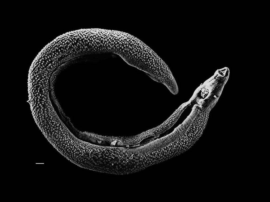 schistosoma-tb