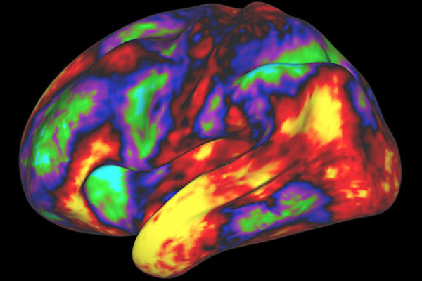 Brain development through adolescence to be focus of national study