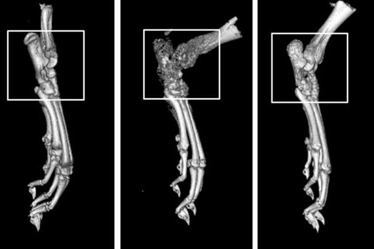 CT bone scans