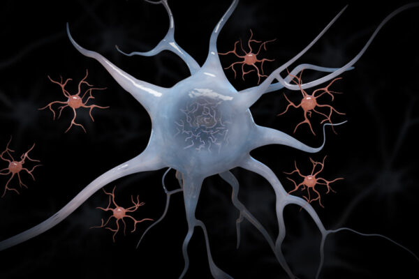 Targeting immune cells may be potential therapy for Alzheimer’s