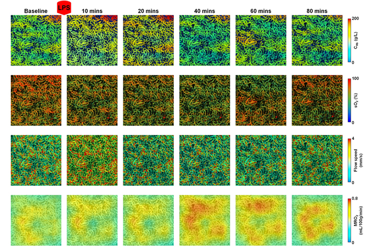 six time lapse photoacoustic microosopy images of metabolic responses of: hemoglobin, oxygen saturation of hemoglobin, blood flow speed, and metabolic rate of oxygen. Images from 10, 20, 40 and 60 minutes