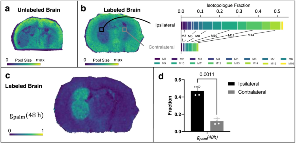 Spatial metabolomics images of a brain with a tumor