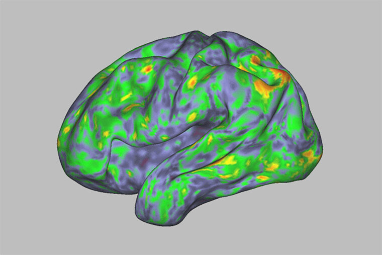 heat map of brain activity