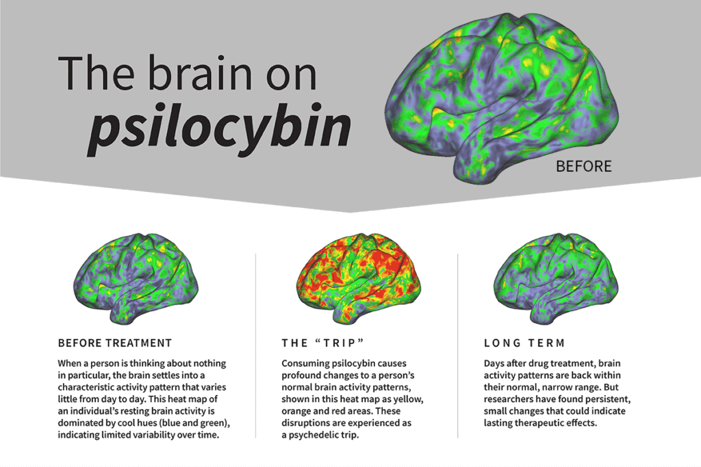 explanation of the brain of psilocybin