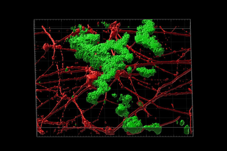 3D reconstruction of amyloid beta plaque deposition between neurons grown in the lab