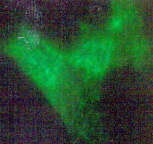 A fluroescent-tagged antibody bearing silver and gold particles reveals I and L bradykinin receptors lit in a ghostly green glow on the surface of cultured human cells