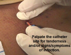ICU personnel are instructed in proper placement of catheters to lower infection risk.