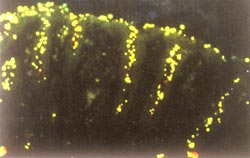 The bacterium Helicobacter pylori is shown here binding to human gastric epithelium.