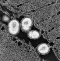 An electron micrograph of strep bacteria infecting muscle tissue
