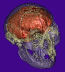Right frontal view of transparent skull with 