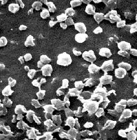 The nanoparticles shown here are irregularly shaped due to the fixing process for electron microscopes. They are normally perfect spheres.