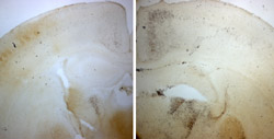 Shown are brain sections of neonatal mice exposed to ethanol. Given the same dose of ethanol, mice deficient in AC1 and AC8 (right) exhibit much more neurodegeneration than normal mice as indicated by the black material in the dying neurons.
