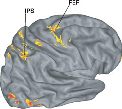 Among the areas activated by tasks designed to stimulate voluntary attention were the intraparietal sulcus and frontal eye fields, both believed to be part of a network of neurons called the dorsal attention system.