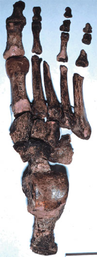 A 26,000 year-old early modern human showing the reduced strength of the bones of the lesser toes.