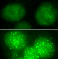These images of cell nuclei treated with damaging radiation show that in the absence of MDC1, repair proteins (bright green areas) are inhibited from gathering at the sites of DNA damage.