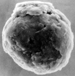 Scanning electron micrograph of a presolar graphite spherule from the Murchison meteorite. The isotopic composition of this unusually large grain, which has an onion-like external morphology, indicates a supernova origin.