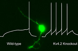 Dorsal horn neurons (shown here in green) have different firing patterns in wild-type mice, which fire less frequently, from those bred without Kv4.2 potassium channels, which fire more often in response to a potentially painful stimulus.