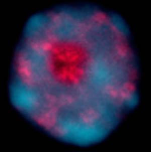The protein HDA6 shows up as a red stain in this *Arabidopsis* leaf cell  nucleus.  WUSTL researchers have proven that HDA6 plays a crucial role in gene silencing.