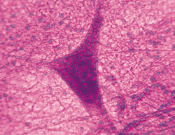 Eliminating a molecular beacon can help protect a neuron (shown here) from destructive immune system cells.