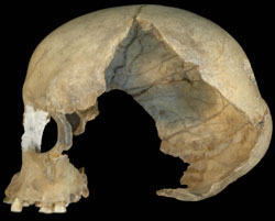 The early modern human cranium from the Pestera Muierii, Romania.