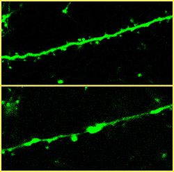Images of brain cells taken before (above) and after seizures in live mice reveal loss of spines, small bumps on the surfaces of brain cell branches. Scientists believe these bumps may be helpful in processes that enable memory, and that loss of these str