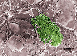 A micrograph reveals an E. coli bacterium (in green) that is part of a community of bacteria known as a biofilm. Researchers are investigating the roles biofilms play in urinary tract infections at the new Center for Women's Infectious Disease Research.