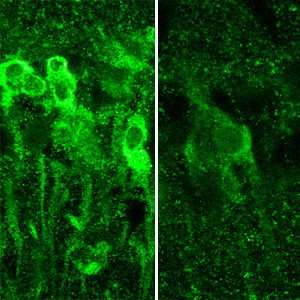 When exposed to large amounts of alcohol, neurons in the hippocampus produce steroids (shown in bright green, at left), which inhibit the formation of memory. Pictured at right, neurons in the same region of the brain that have not been exposed to alcohol./Kazuhiro Tokuda