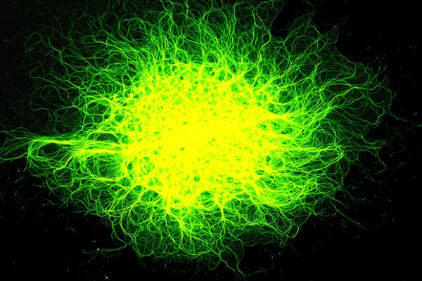 Scientists identify clue to regrowing nerve cells