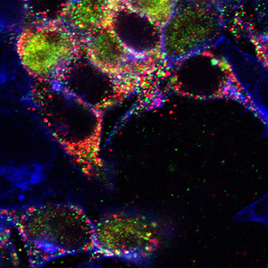 When exposed to the protein CLCA1 (red), human cells start to express the chloride ion channel TMEM16A (green) on their surface. New research at Washington University suggests this protein and channel may work together in the overproduction of mucus characteristic of diseases such as asthma and chronic obstructive pulmonary disease (COPD).