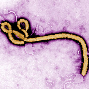 Ebola is among the emerging infectious diseases that will be discussed at the third annual conference of the Washington University Center for Global Health and Infectious Disease.