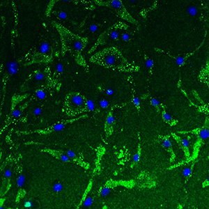 New research explains how immune cells called macrophages (green) in the lung sometimes stick around too long, even after clearing a viral infection, leading to long-term lung problems. Macrophage nuclei are shown in blue. 