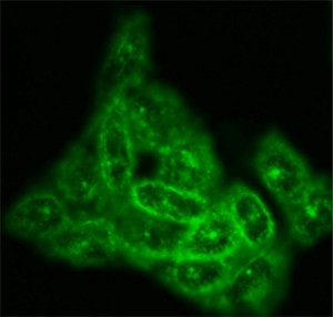 Cholesterol is a building block of steroid hormones, which trigger puberty and support pregnancy. New research implicates a regulator of cholesterol in cells’ ability to make these hormones, a finding that may help scientists investigate the causes of infertility and early onset puberty. Above, green staining shows the distribution of cholesterol in normal hamster ovary cells. (Photo: D. Ory)