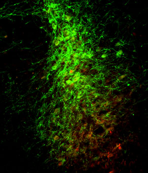 Neurons in the mouse brain appear green as they produce a substance that makes them sensitive to light. The red marks the presence of norepinephrine, which surges under stress.