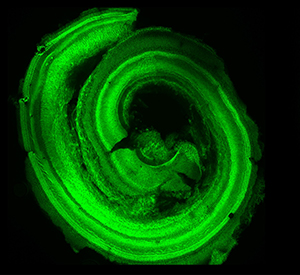 A normal mouse cochlea shows a characteristic spiral shape. 