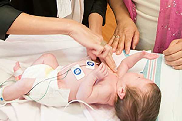 Preemies at high risk of autism don’t show typical signs of disorder in early infancy