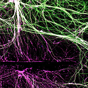 To study how peripheral neurons regrow axons — the branches of nerve cells that transmit nerve signals — researchers at Washington University School of Medicine in St. Louis grow them in a dish, cut them (as shown) and observe how they regrow. The researchers, led by Valeria Cavalli, PhD, have identified a master gene that enables repair of these branches when they are cut.