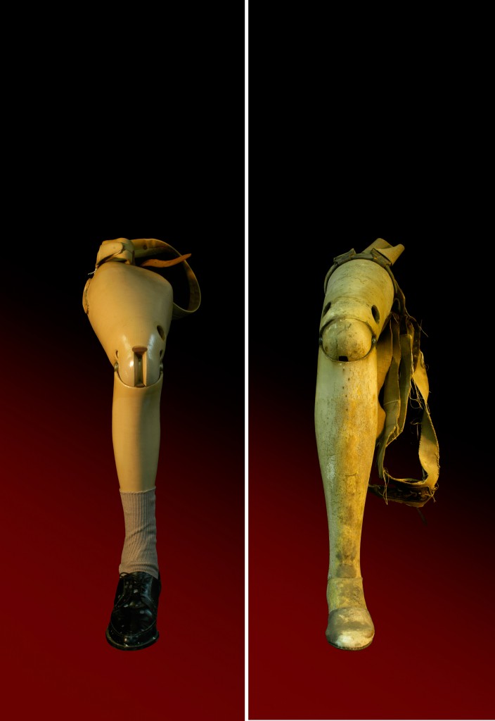 Photograph of prosthetic leg.