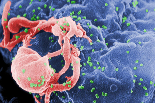 Bacteria, viruses in gut linked to severity of HIV infection