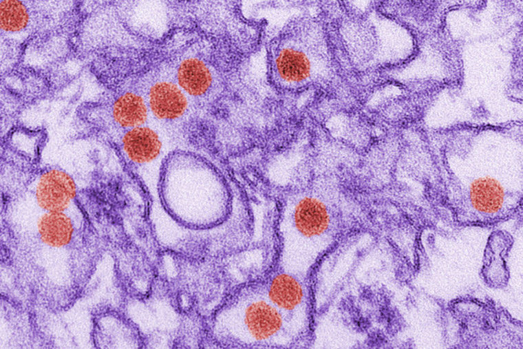 Image of the Zika virus