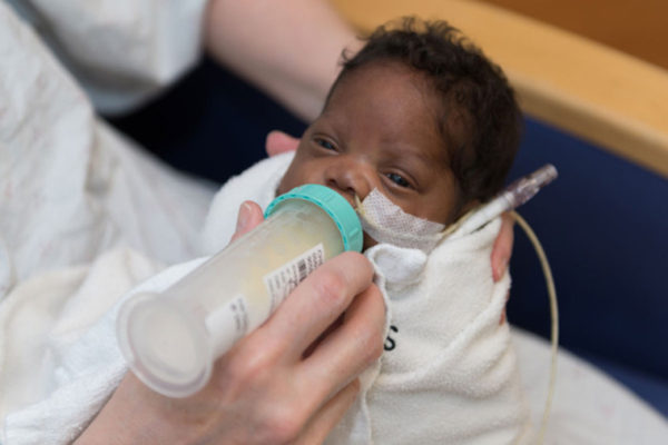 Breast milk linked to significant early brain growth in preemies