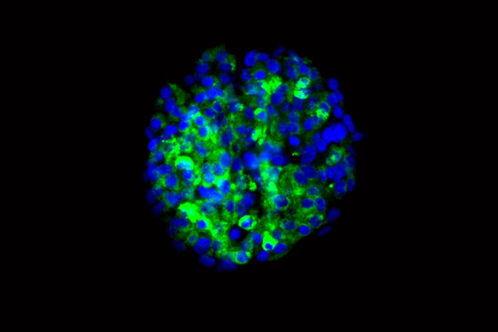 Researchers have produced insulin-secreting cells from stem cells derived from the skin of patients with type 1 diabetes. The cells (blue), made from stem cells, can secrete insulin (green) in response to glucose. (Image: Millman Laboratory)