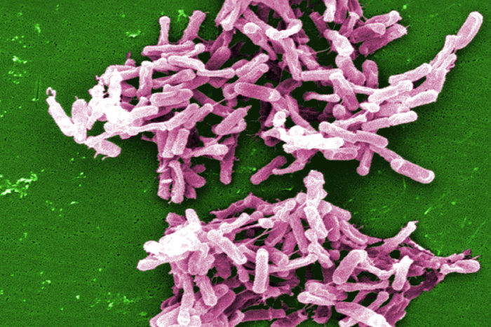 This micrograph depicts C. difficile bacteria, which can cause severe diarrhea, fever, intestinal pain and, in some cases, death. The infection can occur after prolonged antibiotic use. (Image: Janice Carr/CDC)