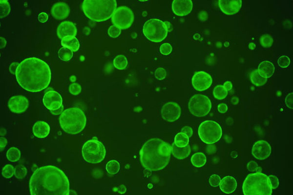 Gut microbes’ metabolite dampens proliferation of intestinal stem cells
