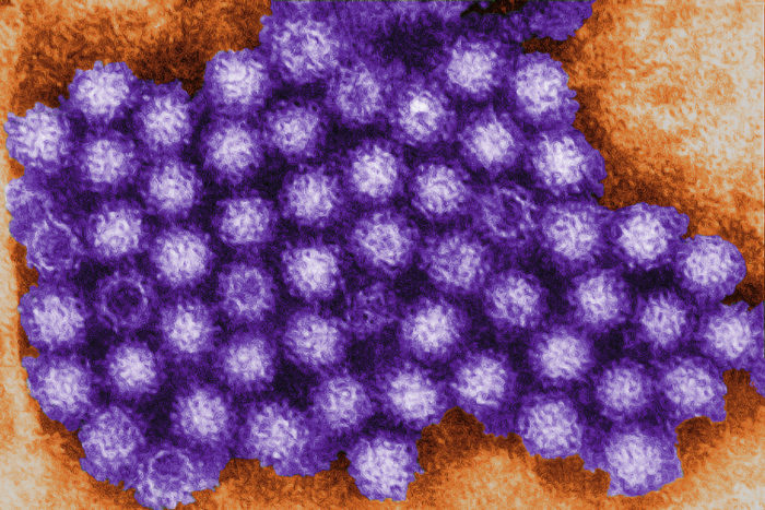 Researchers at Washington University School of Medicine in St. Louis have identified the protein that norovirus – shown above in a colored transmission electron micrograph – uses to invade cells. Norovirus is the most common viral cause of diarrhea worldwide, but scientists still know little about how it infects people and causes disease because the virus grows poorly in the lab. (Image: CDC/Charles D. Humphrey)
