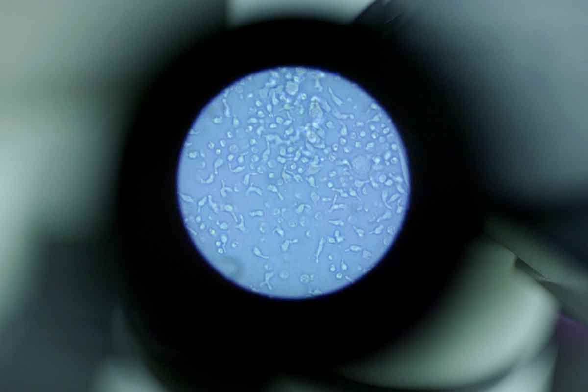 NK cells through a microscope