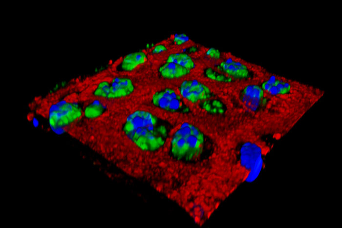 Researchers at Washington University School of Medicine in St. Louis have found that injecting nanoparticles into an injured joint can inhibit the inflammation that contributes to the cartilage damage seen in osteoarthritis. Shown in green is an inflammatory protein in cartilage cells. After nanoparticles are injected, the inflammation is greatly reduced. (Image: Pham Laboratory)