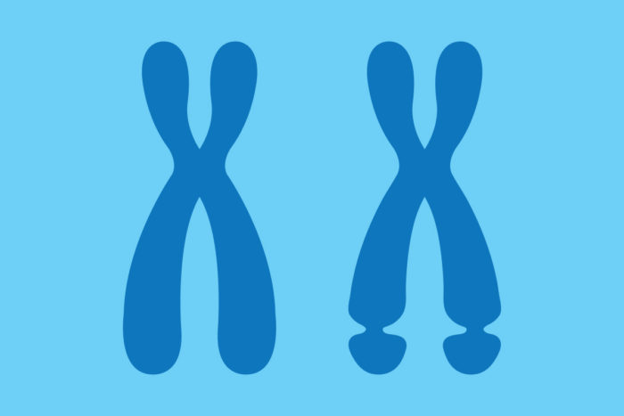 A new explanation for some of the symptoms of fragile X syndrome, the most common inherited cause of intellectual disability, has been proposed by researchers at Washington University School of Medicine in St. Louis. Their explanation suggests new targets for treatment. (Image: Michael Worful)